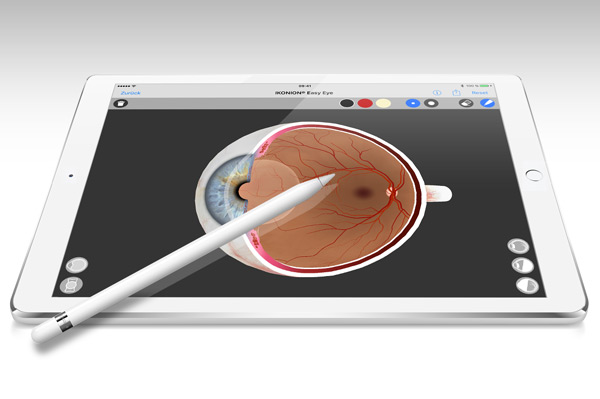 Neues Feature: Interaktives 3D-Augenmodell mit Malfunktion